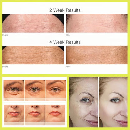 Retinol Shot 